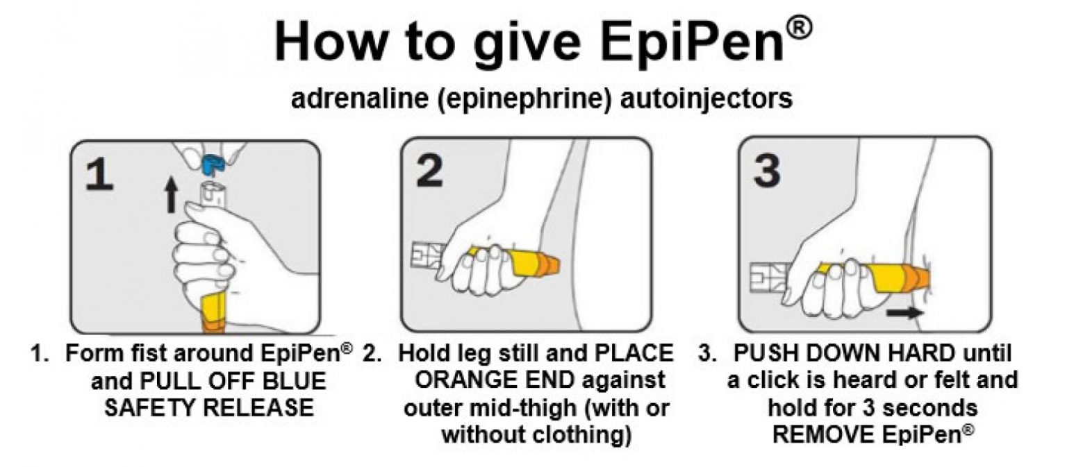 Using your EpiPen® or Anapen® ALLERGY 250K