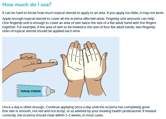 Managing eczema