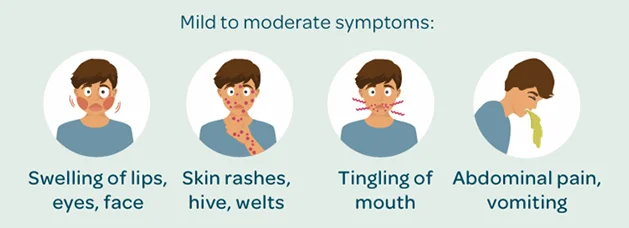 Mild to moderate symptoms of an allergic reaction